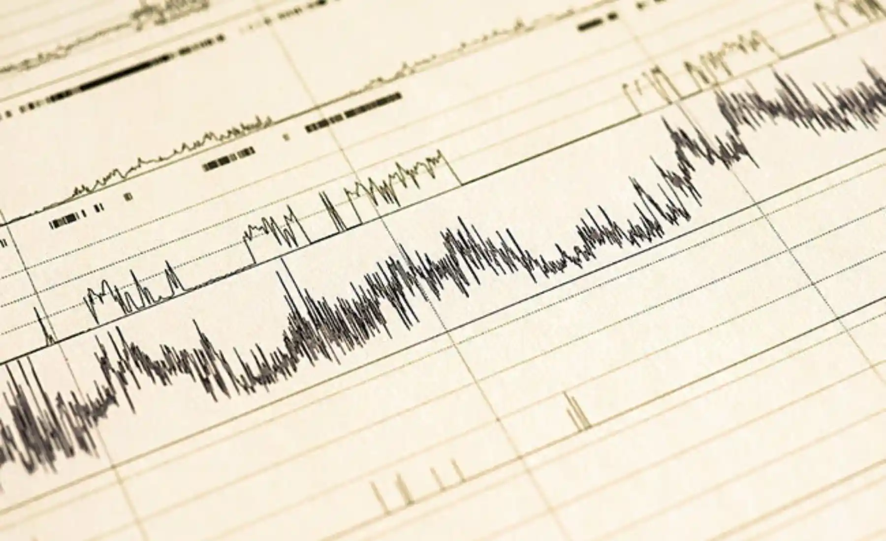 Polysomnographie Ausdruck Neuromobil