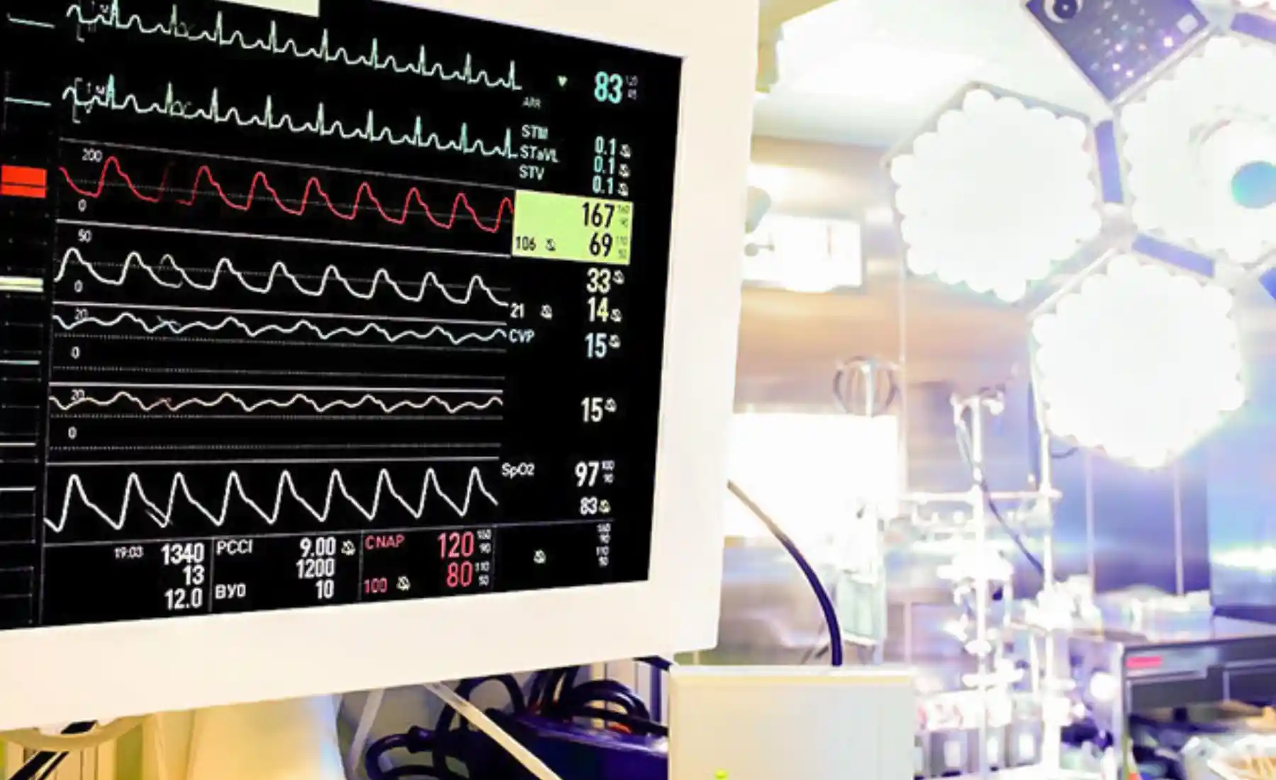 Monitoring during intraoperative neurophysiological procedures