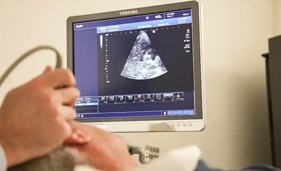 Hirnparenchym Sonographie Darstellung Substantia nigra Neuromobil